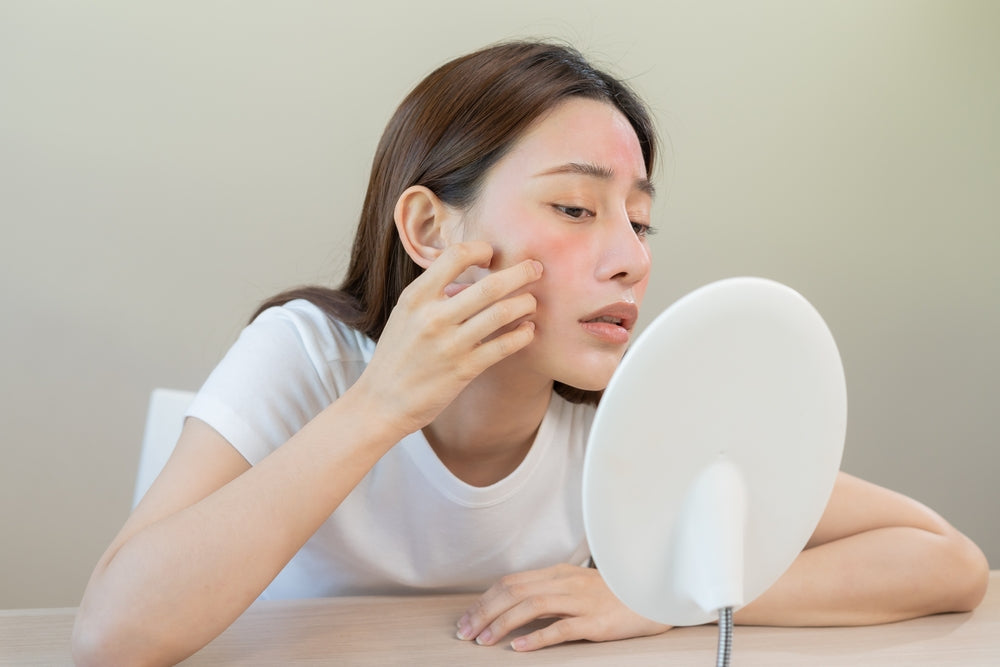 Why My Face Keeps Reacting to Products